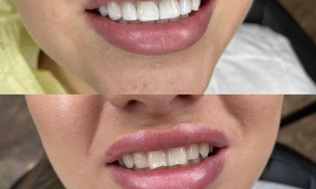 Фото медцентра Hayat dental clinic - Фотография 1