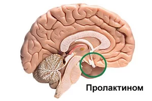 Аденома гипофиза - симптомы, причины, виды и лечение у взрослых в Москве в «СМ-Клиника»