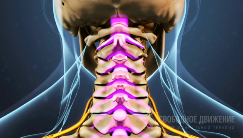 Шейный спондилоартроз - 1