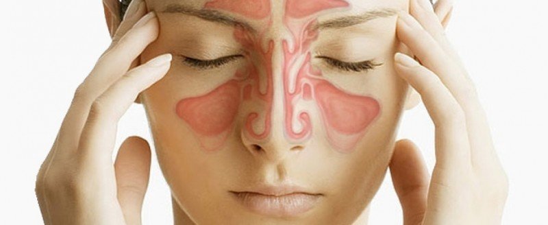 Доброкачественные опухоли полости носа - 1