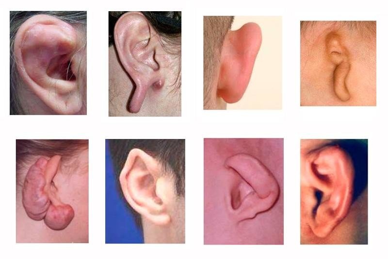 Можно ли восстановить внешний вид травмированных ушей? - 1