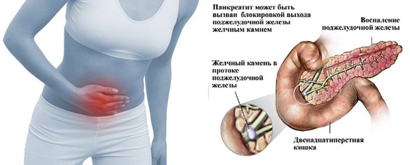 Удаление камней в поджелудочной железе: цены в Санкт-Петербурге в «СМ-Клиника»