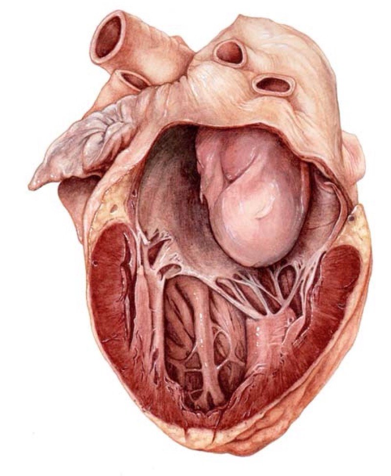Опухоли сердца - 1