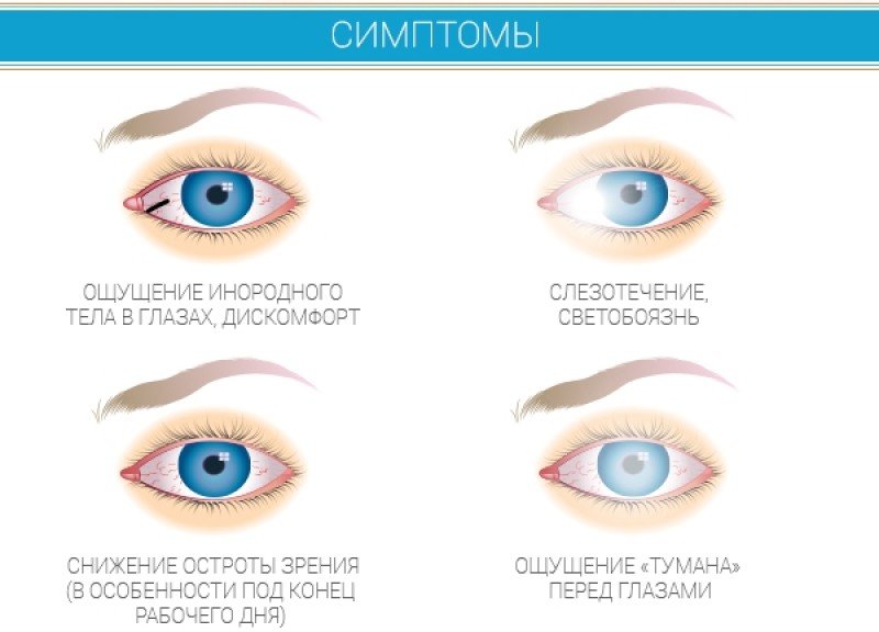 Доклад по теме Причины возникновения и проявления синдрома сухих глаз