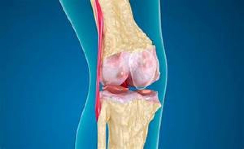 Тендинит коленного сухожилия - 2