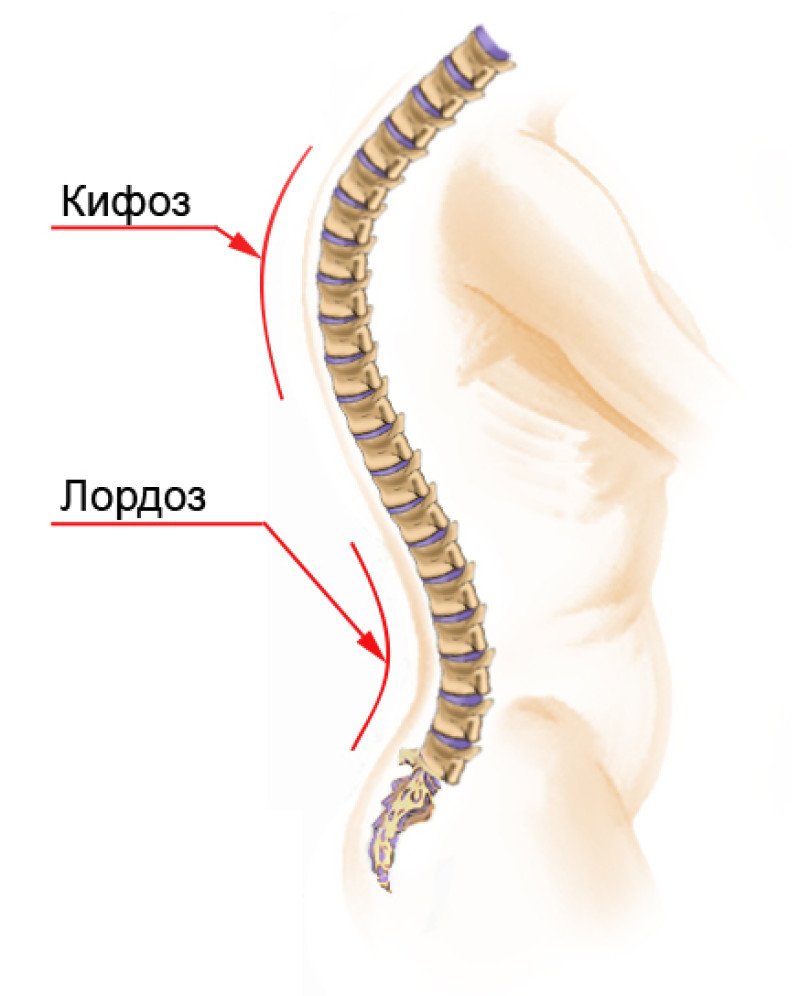 Лордоз - 1