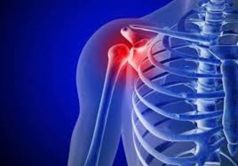 Сколько болит перелом плечевой кости