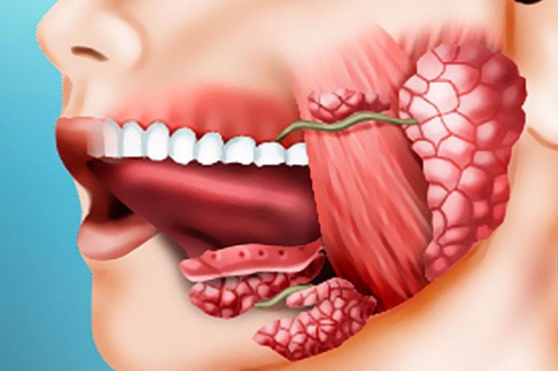 Доброкачественные опухоли полости рта - 1