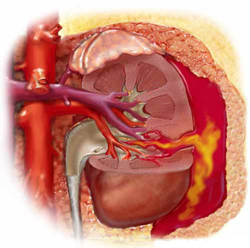 Травмы органов мочеполовой системы