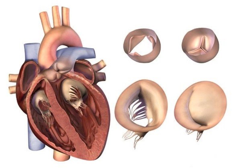 Приобретенный порок сердца - 1