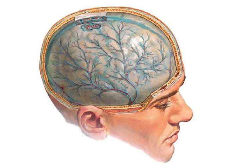 Киста головного мозга - 2