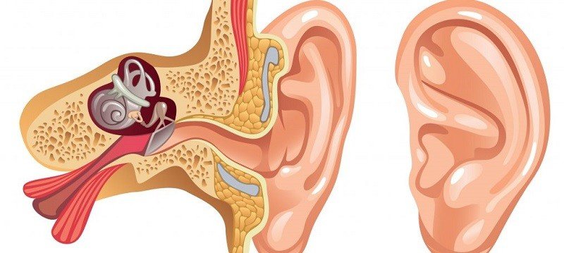 Холестеатома уха - 2