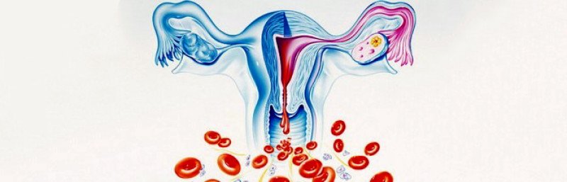 Кровотечение у женщин без болей причины