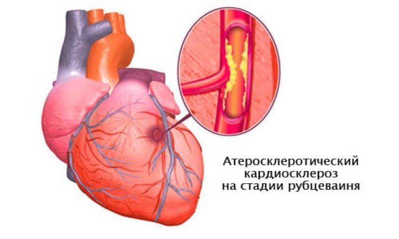 Вопрос посетителя 'Наташа, Харьков' №, Консультация кардиолога - Портал пластиковыеокнавтольятти.рф