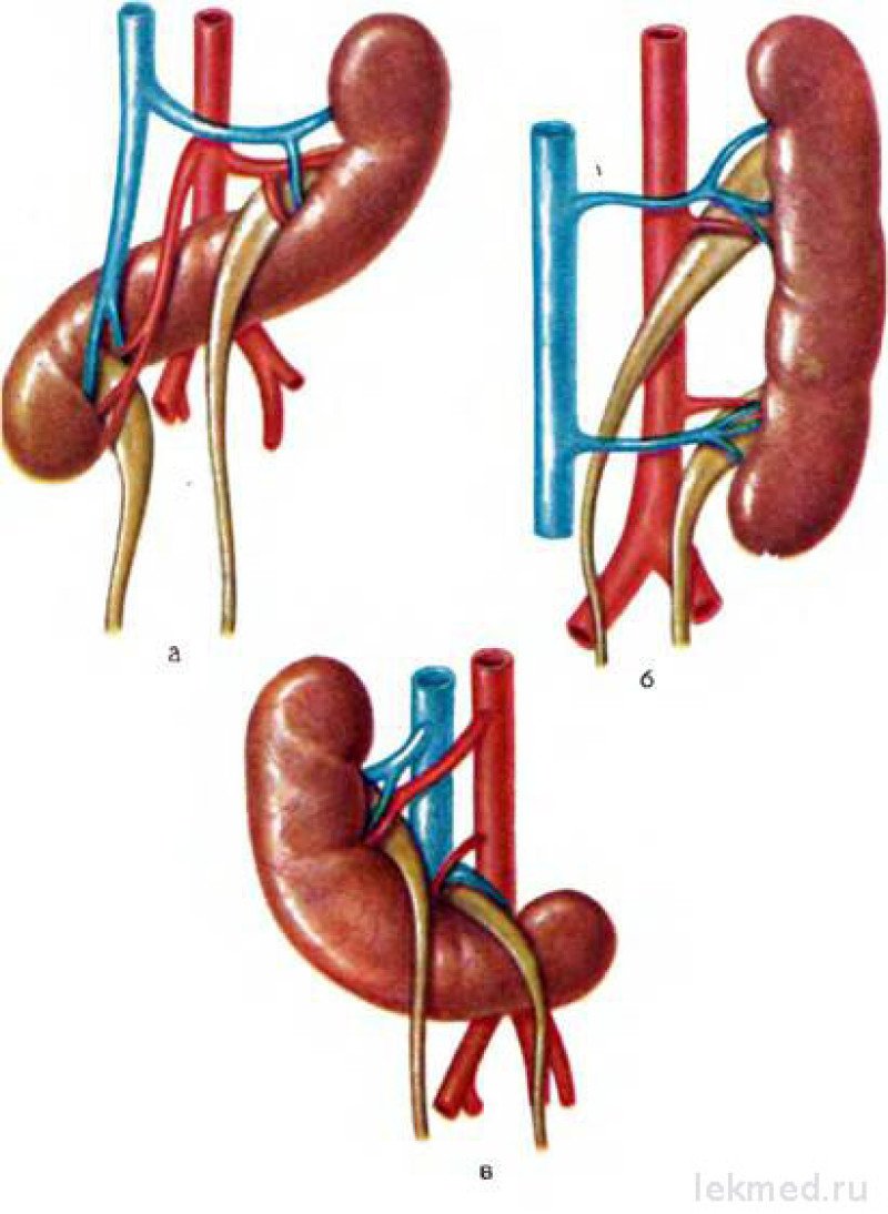 Сращение почек - признаки, причины, симптомы, лечение и профилактика -  iDoctor.kz